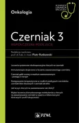 Czerniak 3. Współczesne podejście. - Piotr Rutkowski