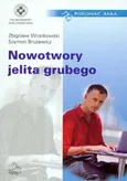 Nowotwory jelita grubego - Outlet - Szymon Brużewicz