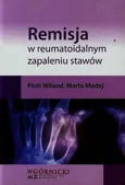 Remisja w reumatoidalnym zapaleniu stawów - Outlet - Marta Madej