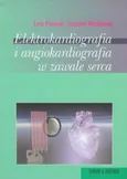 Elektrokardiografia i angiokardiografia w zawale serca - Lech Poloński