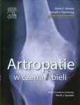 Artropatie w czerni i bieli - Brower Anne C.