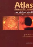 Atlas diagnostyki i terapii zwyrodnienia plamki związanego z wiekiem - Jan Kucharczuk