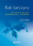 Rak tarczycy Aktualne metody diagnostyki i leczenia - Barbara Jarząb