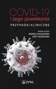 COVID-19 i jego powikłania - przypadki kliniczne - Outlet - Jerzy Kruszewski