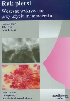 Rak piersi wczesne wykrywanie przy użyciu mammografii - Dean Peter B., Laszlo Tabar, Tibor Tot