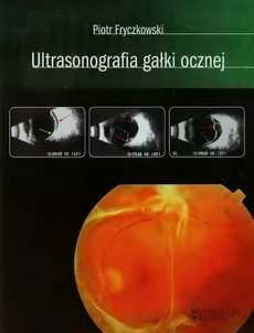 Ultrasonografia gałki ocznej - Piotr Fryczkowski