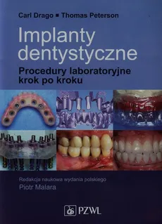 Implanty dentystyczne - Carl Drago, Thomas Peterson