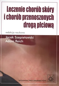 Leczenie chorób skóry i chorób przenoszonych drogą płciową - Adam Reich, Jacek Szepietowski