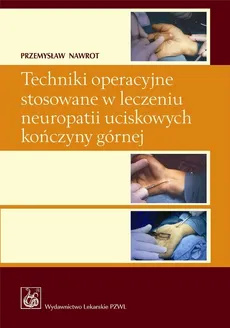 Techniki operacyjne stosowane w leczeniu neuropatii uciskowych kończyny górnej z płytą CD - Przemysław Nawrot