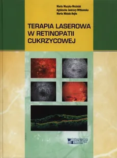 Terapia laserowa w retinopatii cukrzycowej - Agnieszka Jamrozy-Witkowska, Marta Misiuk-Hojło, Maria Muzyka-Woźniak