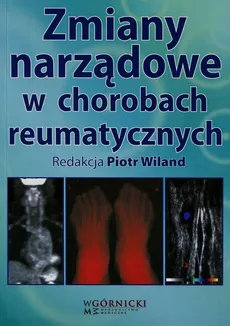 Zmiany narządowe w chorobach reumatycznych - Piotr Wiland