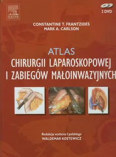 Atlas chirurgii laparoskopowej i zabiegów małoinwazyjnych - Outlet - Carlson Mark A., Frantzides Constantine T.