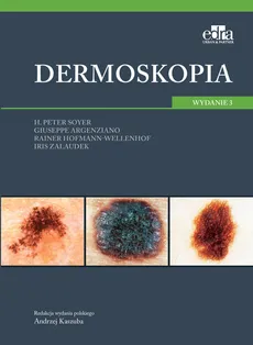 Dermoskopia - G. Argenziano, R. Hofmann-Wellenhof, H.P. Soyer, I. Zalaudek