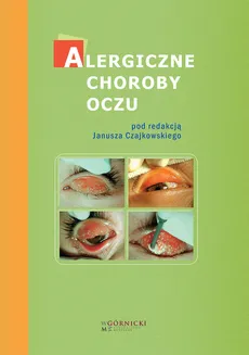 Alergiczne choroby oczu - Ewa Bogacka, Janusz Czajkowski, Józef Małolepszy