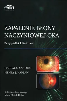 Zapalenie błony naczyniowej oka - H.J. Kaplan, H.S. Sandhu
